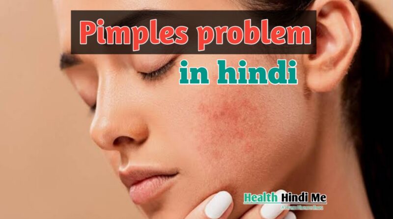 pimples problem